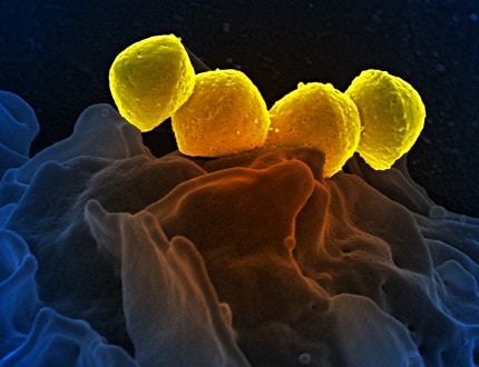 A microscopic view of the Streptococcus bacteria