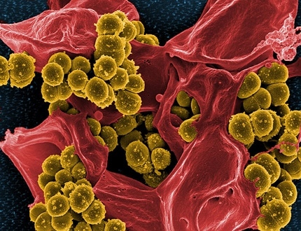 A microscopic of the Staphylococcus bacteria