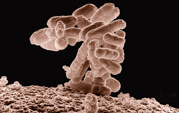 Escherichia Coli